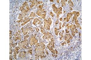 IHC analysis of PPA1 using anti-PPA1 antibody (ABIN6719527). (Pyrophosphatase (Inorganic) 1 (PPA1) (AA 7-236) 抗体)