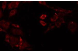 ABIN6277898 staining Hela by IF/ICC. (Renin 抗体  (Internal Region))