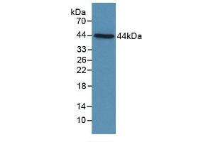 Detection of Recombinant C4d, Human using Polyclonal Antibody to Complement Component 4d (C4d) (Complement C4d 抗体  (AA 958-1335))