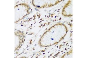 Immunohistochemistry of paraffin-embedded human gastric using UBE3A antibody. (ube3a 抗体  (AA 300-590))
