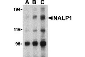 Western Blotting (WB) image for anti-NLR Family, Pyrin Domain Containing 1 (NLRP1) (C-Term) antibody (ABIN1030530) (NLRP1 抗体  (C-Term))