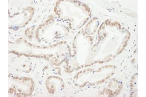 Immunohistochemistry (IHC) image for anti-Chromobox Homolog 5 (CBX5) (C-Term) antibody (ABIN7453932)
