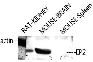 Western Blotting (WB) image for anti-Prostaglandin E Receptor 2 (Subtype EP2), 53kDa (PTGER2) (C-Term) antibody (ABIN3174961) (PTGER2 抗体  (C-Term))