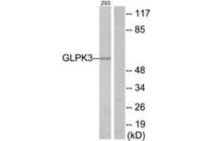 Western Blotting (WB) image for anti-Glycerol Kinase (GK) (AA 21-70) antibody (ABIN2889590) (Glycerol Kinase 抗体  (AA 21-70))