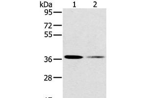 Western Blot analysis of 293T and Raji cell using SMN1 Polyclonal Antibody at dilution of 1:200 (SMN1 抗体)