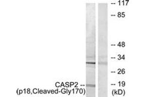 Western blot analysis of extracts from Jurkat cells, treated with etoposide 25uM 24h, using Caspase 2 (p18,Cleaved-Gly170) Antibody. (Caspase 2 抗体  (Cleaved-Gly170))