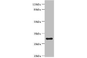 Western blot All lanes: 39S ribosomal protein L28, mitochondrial antibody at 2 μg/mL + Hela whole cell lysate Secondary Goat polyclonal to rabbit IgG at 1/10000 dilution Predicted band size: 30 kDa Observed band size: 30 kDa (MRPL28 抗体  (AA 1-256))