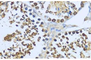Immunohistochemistry (Paraffin-embedded Sections) (IHC (p)) image for anti-Heat Shock Protein 90kDa alpha (Cytosolic), Class A Member 1 (HSP90AA1) antibody (ABIN7256124)