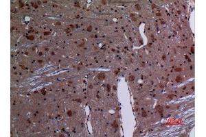 Immunohistochemistry (IHC) analysis of paraffin-embedded Rat Brain, antibody was diluted at 1:100. (RAB26 抗体  (C-Term))