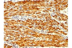 Formalin-fixed, paraffin-embedded human Uterus stained with Calponin Rabbit Recombinant Monoclonal Antibody (CNN1/1408R). (Recombinant CNN1 抗体)