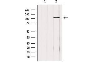 Western blot analysis of extracts from mouse brain, using USP11 Antibody. (USP11 抗体  (Internal Region))