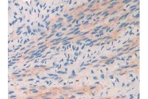 DAB staining on IHC-P; Samples: Mouse Oviduct Tissue (COL2A1 抗体  (AA 1307-1383))