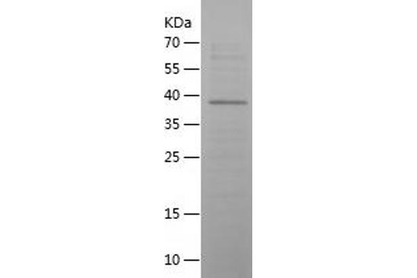 Vip Protein (AA 26-170) (His-IF2DI Tag)