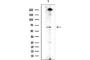 anti-SP110 Nuclear Body Protein (SP110) antibody