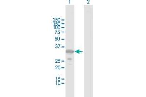 Western Blot analysis of ZMAT3 expression in transfected 293T cell line by ZMAT3 MaxPab polyclonal antibody. (ZMAT3 抗体  (AA 1-289))