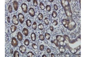 Image no. 1 for anti-Zinc Finger Protein 259 (znf259) (AA 361-460) antibody (ABIN598588) (ZNF259 抗体  (AA 361-460))