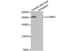 Western blot analysis of extracts from A431 cells using Phospho-ERBB3-Y1328 Antibody (ERBB3 抗体  (pTyr1328))