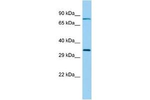 Host: Rabbit Target Name: RSPH9 Sample Type: Fetal Lung lysates Antibody Dilution: 1. (RSPH9 抗体  (Middle Region))