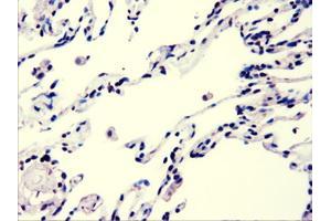 Immunohistochemistry (IHC) image for anti-V-Akt Murine Thymoma Viral Oncogene Homolog 3 (Protein Kinase B, Gamma) (AKT3) antibody (ABIN2715859)