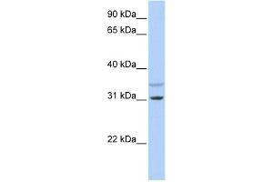 WB Suggested Anti-KCNRG Antibody Titration:  0. (KCNRG 抗体  (N-Term))