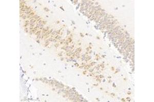 Immunohistochemistry analysis of paraffin-embedded mouse hippocampus using VAMP4 (ABIN7076198) at dilution of 1: 3000 (VAMP4 抗体)