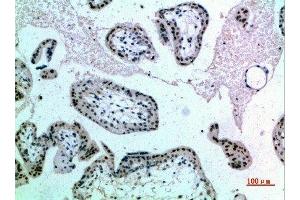 Immunohistochemical analysis of paraffin-embedded human-placenta, antibody was diluted at 1:200 (NOP56 抗体  (AA 191-240))