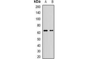 Western blot analysis of AF9 expression in Jurkat (A), A549 (B) whole cell lysates. (AF9 抗体)