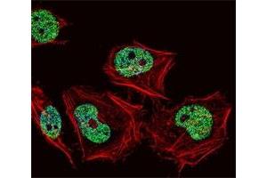 Fluorescent confocal image of HeLa cell stained with CUX1 antibody at 1:25. (CUX1 抗体  (AA 1347-1374))