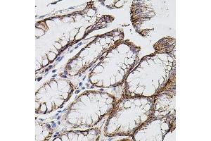 Immunohistochemistry of paraffin-embedded human stomach using MMP9 antibody (ABIN7268426) at dilution of 1:100 (40x lens). (MMP 9 抗体  (AA 400-500))