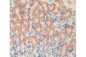 Used in DAB staining on fromalin fixed paraffin- embedded Kidney tissue (PLXNB1 抗体  (AA 1598-1849))