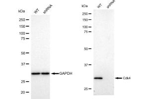 Western blotting analysis using Cdk4 antibody (ABIN7798214). (Recombinant CDK4 抗体)