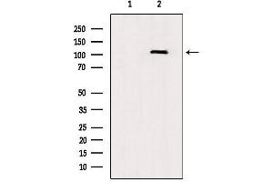 Western blot analysis of extracts from rat brain, using TLR8  Antibody. (TLR8 抗体  (C-Term))