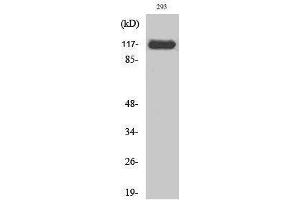 Western Blotting (WB) image for anti-Janus Kinase 2 (JAK2) (Ser642) antibody (ABIN3185258) (JAK2 抗体  (Ser642))