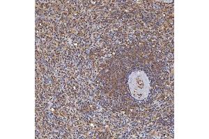 IHC analysis of Sm-D3/SNRPD3 using anti-Sm-D3/SNRPD3 antibody (ABIN7598952). (SNRPD3 抗体  (AA 1-112))