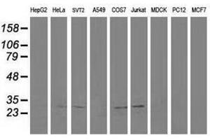 Image no. 5 for anti-Cyclin-Dependent Kinase 2 (CDK2) antibody (ABIN1497398)