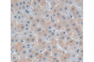 Used in DAB staining on fromalin fixed paraffin- embedded liver tissue (PLCD1 抗体  (AA 1-234))