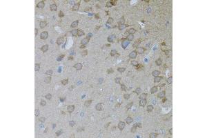 Immunohistochemistry of paraffin-embedded mouse brain using ARF1 antibody. (ARF1 抗体)