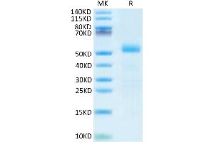 SDS-PAGE (SDS) image for delta Like Protein 3 (DLL3) (AA 33-488) protein (His tag) (ABIN7274488)