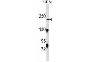 NHSL1 Antibody (Center) (ABIN1538546 and ABIN2849679) western blot analysis in CEM cell line lysates (35 μg/lane). (NHSL1 抗体  (AA 632-661))