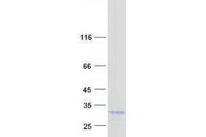 Western Blotting (WB) image for Peptidylprolyl Isomerase C (Cyclophilin C) (PPIC) protein (Myc-DYKDDDDK Tag) (ABIN2712735)