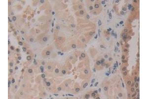 Immunohistochemistry (IHC) image for anti-Heat Shock 70kDa Protein 1A (HSPA1A) (AA 285-641) antibody (ABIN7443083)