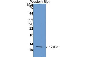 Western Blotting (WB) image for anti-Interleukin 12 Receptor, beta 2 (IL12RB2) (AA 559-647) antibody (ABIN3207283) (IL12RB2 抗体  (AA 559-647))
