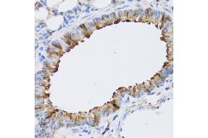 Immunohistochemistry of paraffin-embedded mouse lung using N antibody (ABIN6129932, ABIN6144318, ABIN6144319 and ABIN6222781) at dilution of 1:100 (40x lens). (NAA10 抗体  (AA 161-235))