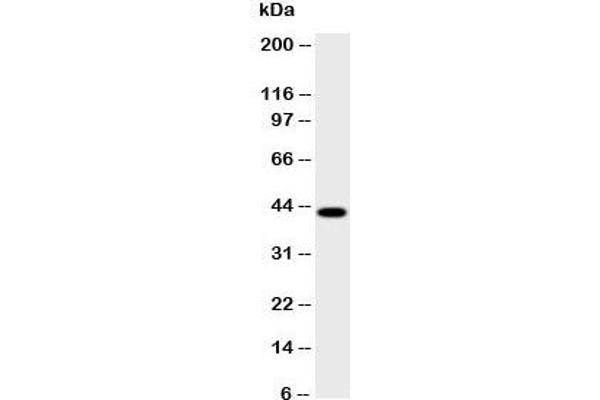 HSD17B2 antibody  (AA 373-387)
