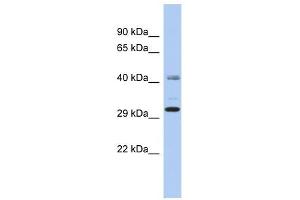 C11ORF46 antibody used at 1 ug/ml to detect target protein. (C11orf46 抗体  (N-Term))