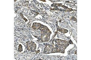 IHC analysis of STAT6 using anti-STAT6 antibody (ABIN7600129).
