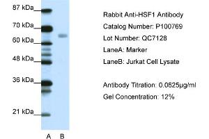 WB Suggested Anti-HSF1  Antibody Titration: 0. (HSF1 抗体  (C-Term))