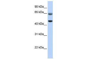 FAM113A antibody used at 1 ug/ml to detect target protein.