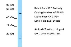 Western Blotting (WB) image for anti-Lipase, Hepatic (LIPC) (C-Term) antibody (ABIN2789506) (LIPC 抗体  (C-Term))