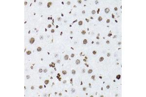 Immunohistochemistry (Paraffin-embedded Sections) (IHC (p)) image for anti-Nuclear Factor of kappa Light Polypeptide Gene Enhancer in B-Cells 2 (NFKB2) (AA 690-899) antibody (ABIN3017388)